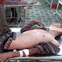 Pháp luật - Hai tên cướp tông vào xe buýt bất tỉnh