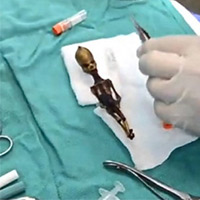 Phi thường - kỳ quặc - Khám "sinh vật ngoài hành tinh" giống người