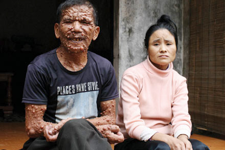 Cuộc đời cơ cực của “người đội lốt quỷ” - 2