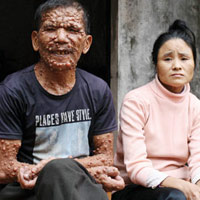 Tin tức trong ngày - Cuộc đời cơ cực của “người đội lốt quỷ”