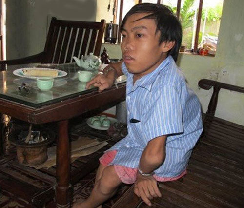 Hà Nội: Chú lùn 70cm và người vợ câm - 2