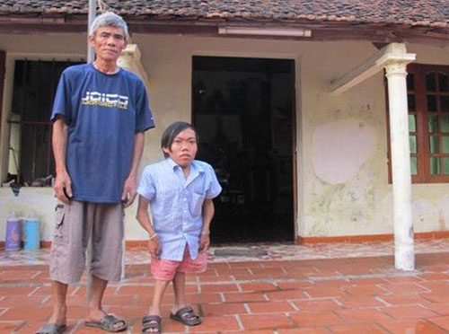 Hà Nội: Chú lùn 70cm và người vợ câm - 3