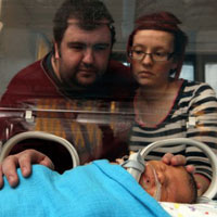 Sức khỏe đời sống - Bé trai bị hở hàm ếch, dính thận, hẹp hàm