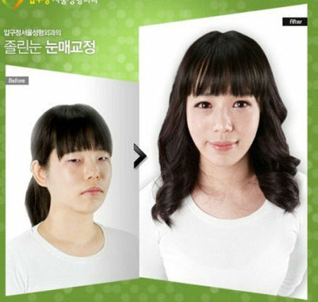Ngỡ ngàng ngắm nhan sắc sau dao kéo (P2) - 6