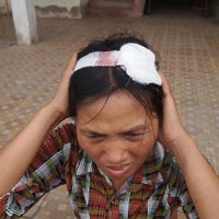 Tin tức trong ngày - Thi công trái luật, thuê giang hồ đánh dân