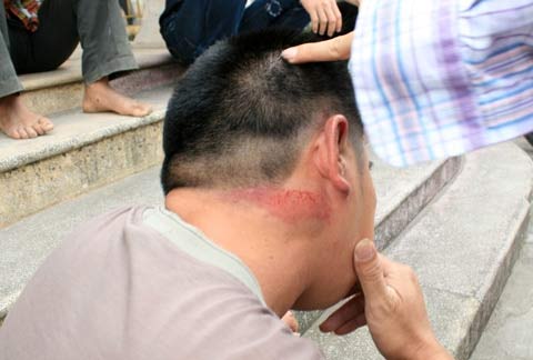 Đằng sau vụ côn đồ hành hung dân Tiên Lãng - 2