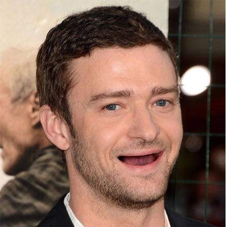 Hết hồn khi sao bị ''rụng răng''! - 10