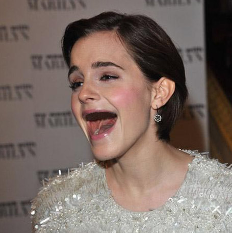 Hết hồn khi sao bị ''rụng răng''! - 13