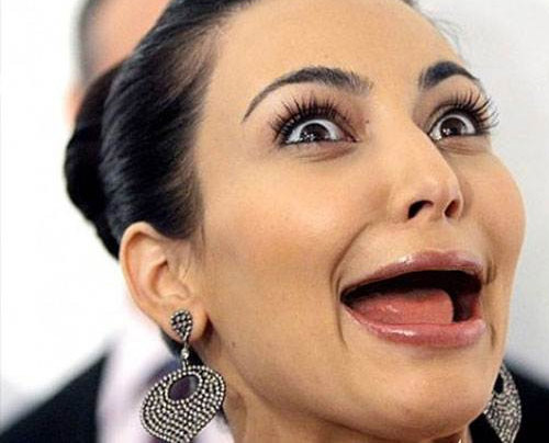 Hết hồn khi sao bị ''rụng răng''! - 4