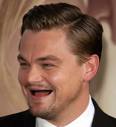 Hết hồn khi sao bị ''rụng răng''! - 7