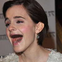 Làm đẹp - Hết hồn khi sao bị ''rụng răng''!