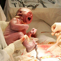 Tin tức trong ngày - Vui vì phá thai giảm, choáng vì vô sinh tăng