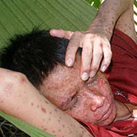 Sức khỏe đời sống - Bệnh 'lạ': Góc nhìn quen của người trong cuộc