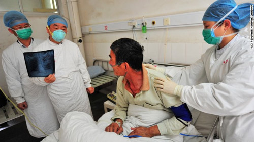 Thế giới cần cảnh giác cao độ trước cúm H7N9 - 1