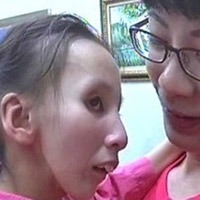 Sức khỏe đời sống - Bé gái 11 tuổi trông như bà lão 80