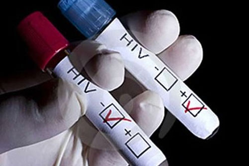 Quan niệm sai lầm về nhiễm HIV - 1