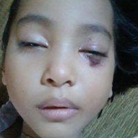 Giáo dục - du học - Không dám đi học vì sợ bị cô đánh?