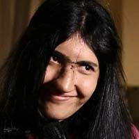 Tin tức trong ngày - Cô gái Afghanistan bị cắt mũi có diện mạo mới