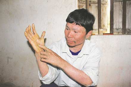 Gia tộc “giời đày” - 2