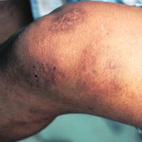 Tin tức trong ngày - Dân tố công an vô cớ bắt giam, đánh đập