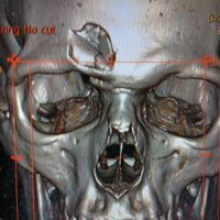 Thể thao - Chấn thương sởn gai ốc ở môn hockey