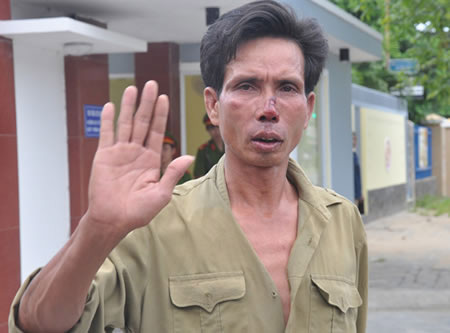 Xe khách và xe ôm xô xát, giữ người của nhau làm con tin - 3