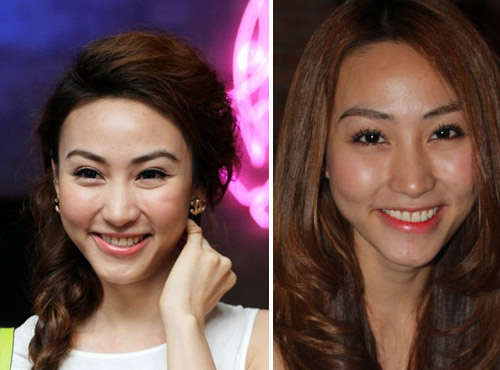 Sốc với gương mặt thay đổi của sao Việt - 8