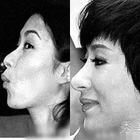 Làm đẹp - Những chiếc mũi được "phù phép" của sao