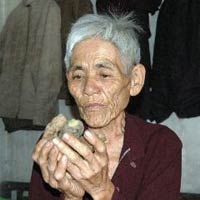 Tin tức trong ngày - Bi kịch không được nghèo