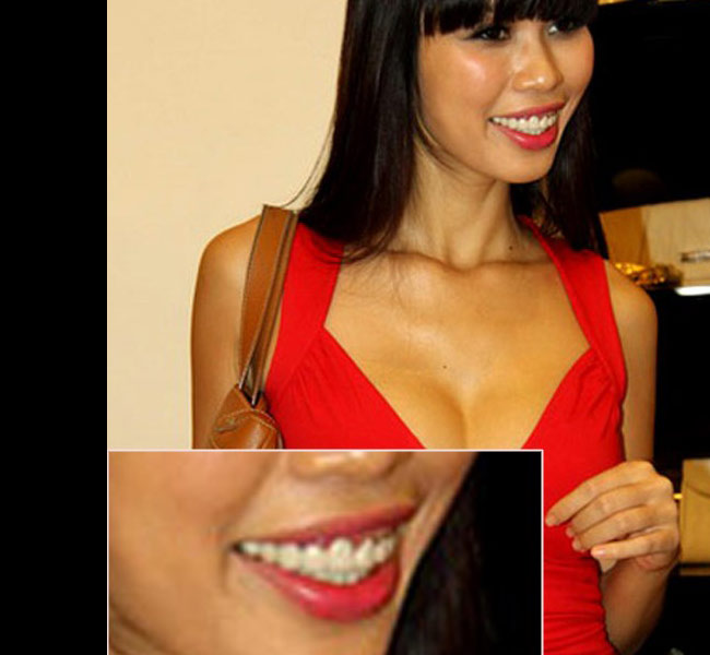 Chiều dài hàm răng Hà Anh hơi ngắn, đó là nguyên nhân khiến cô cười hở lợi.