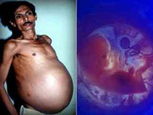 10 người dị nhất quả đất - 2