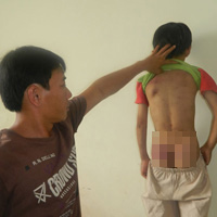 Tin tức trong ngày - Hận vợ cũ, cha trút đòn thù vào con