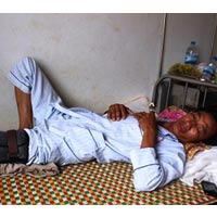 Pháp luật - Phó công an xã bị tố đánh dân vỡ đầu gối