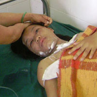 Pháp luật - Đòi ly hôn, bị chồng "luộc" nước sôi