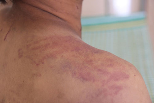 Khởi tố vụ án cha trút đòn thù vào con - 1