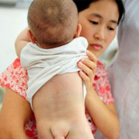 Sức khỏe đời sống - Thương tâm bé trai “mọc đuôi”