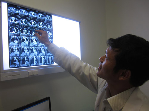 Cắt khối bướu khổng lồ cho bệnh nhân Campuchia - 1