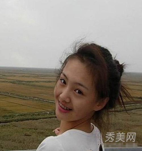 Xem người công chúng thời... niềng răng - 3