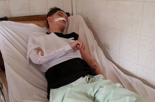 Gặp cướp, 'hot boy' Kelbin Lei nhập viện với nhiều vết thương - 1