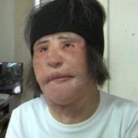 Ca nhạc - MTV - "Thảm họa dao kéo" xứ Hàn ngại ra đường