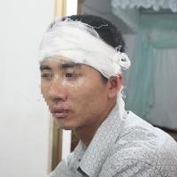 Pháp luật - Giám đốc Công ty cơ khí bị truy sát ở quán bia