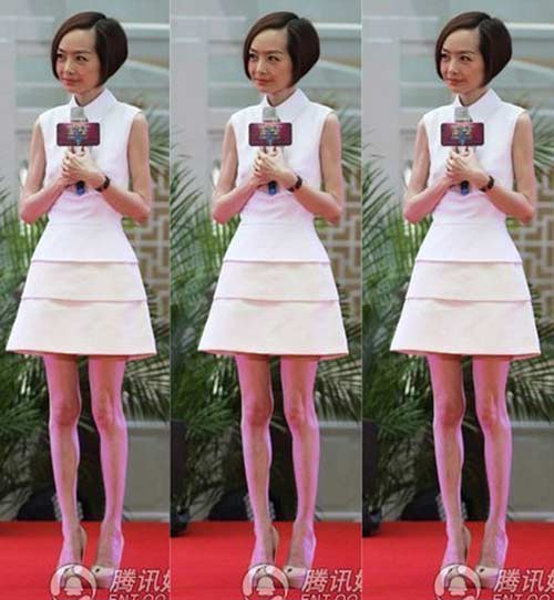 Giật mình nhìn kiều nữ lộ chân "que củi" - 4