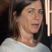 Vợ cũ Brad Pitt gây sốc với gương mặt già nua