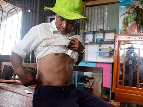 Người nghèo rủ nhau “bán” thận trả nợ - 2