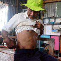 Tin tức trong ngày - Người nghèo rủ nhau “bán” thận trả nợ