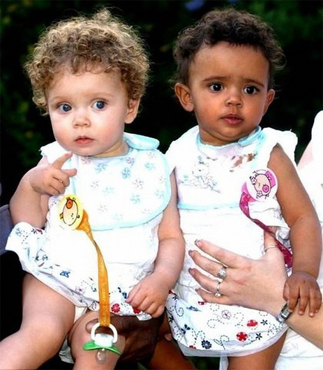Marcia và Millie Biggs cũng là một cặp sinh đôi khác màu da trên thế giới

