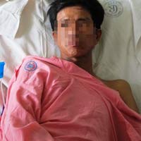 Sức khỏe đời sống - Suýt chết vì hóc xương gà