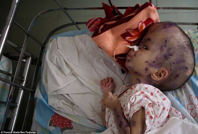 Báo Anh: "Nỗi đau da cam" ở VN khiến tim bạn "tan chảy" - 1