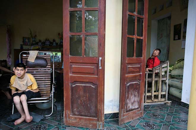 Báo Anh: "Nỗi đau da cam" ở VN khiến tim bạn "tan chảy" - 10