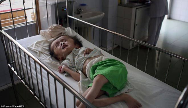 Báo Anh: "Nỗi đau da cam" ở VN khiến tim bạn "tan chảy" - 2